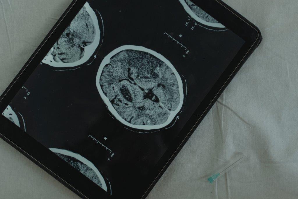 Tablet transmitindo uma tomografia